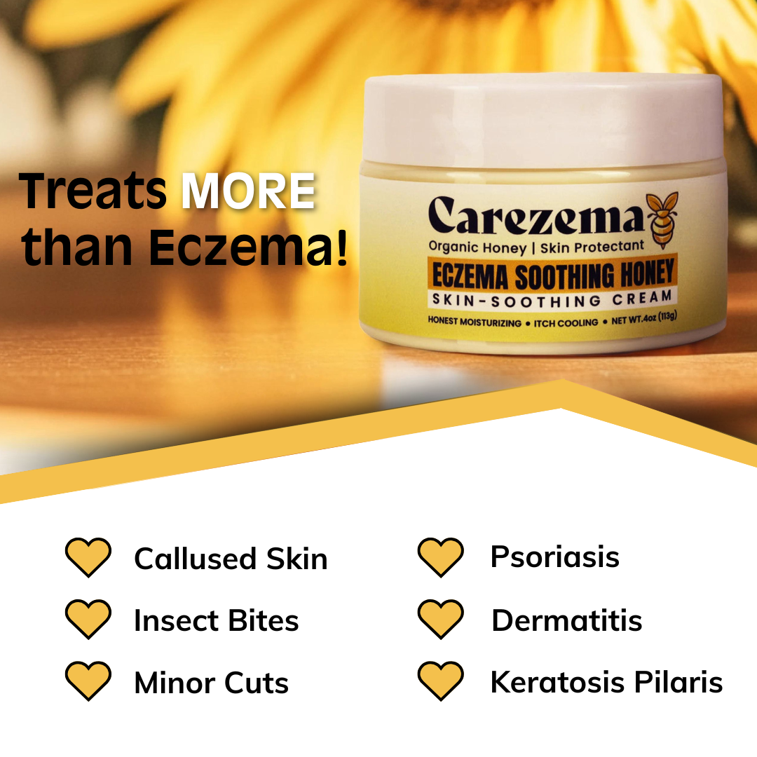 Carezema Eczema Soothing Honey | Buy One, Get One Free